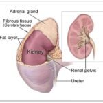 Adrenal Tumor