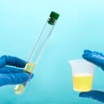 urine analysis laboratory 96336 1417