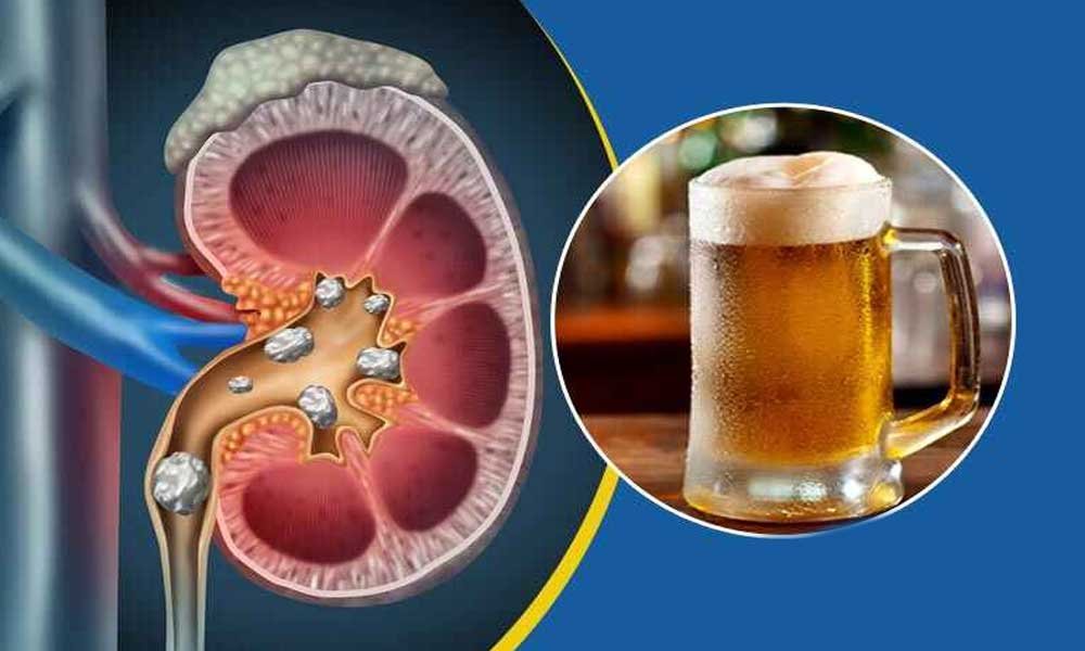 Impact of Regular Whisky Consumption on Kidney Health - Dr. Aditya K ...