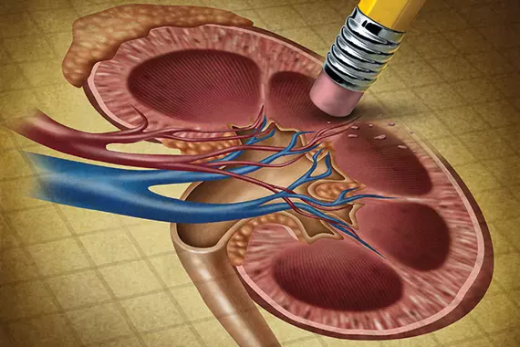 damage kidney