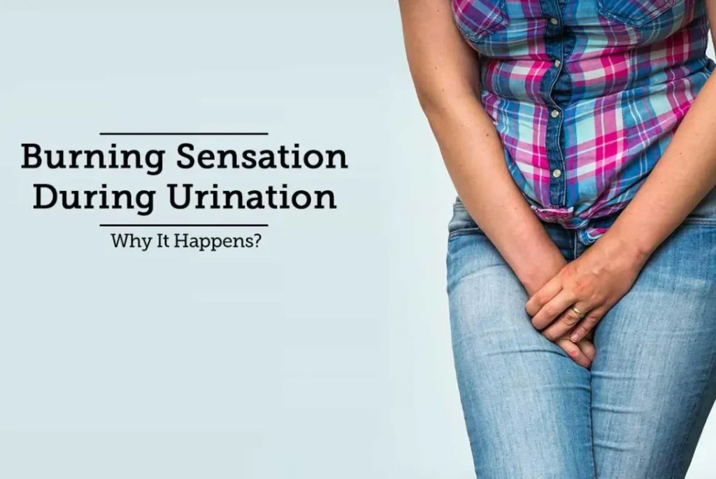 Burning Sensation During urination